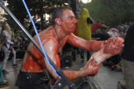 HAEMORRHAGE